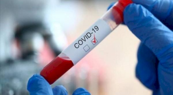 Covid-19 : la Banque mondiale dégage 12 milliards de dollars pour fournir des vaccins aux pays pauvres
